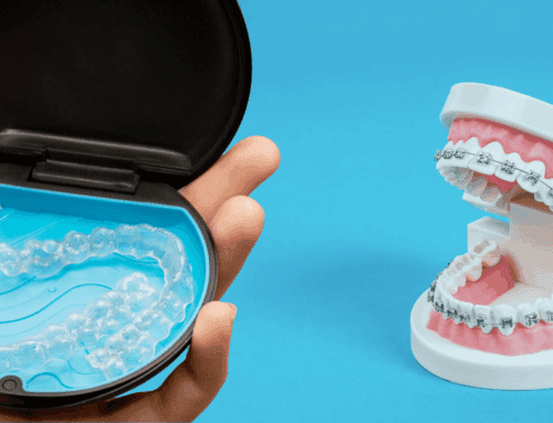 Invisalign vs. Braces: A 2026 Comparison for Adults