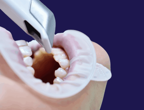 Why Choose GDW for Your Invisalign in East Cobb?