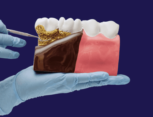 The Ticking Time Bomb: How Gum Disease Can Impact Overall Health