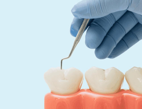 What Is Scaling and Root Planing? A Gentle Guide to Deep Cleaning