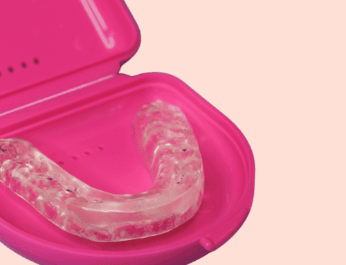 Tired of Headaches? Get Your Custom TMJ Appliance at GDW